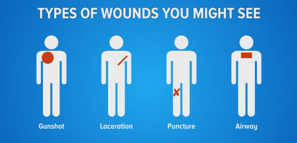a graphic illustrating the types of wounds you'll need to learn to treat for an active shooter response.